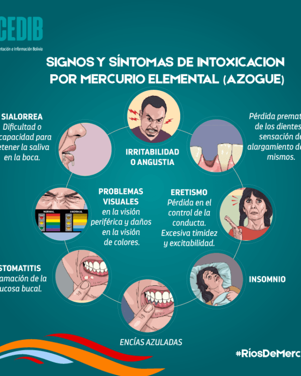 Ríos de mercurio: Signos de intoxicación por mercurio elemental Ríos de mercurio: Signos de intoxicación por mercurio elemental