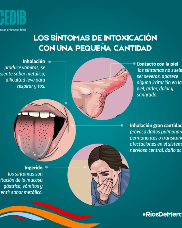 Ríos de mercurio: Signos de intoxicación por mercurio en pequeña cantidad Ríos de mercurio: Signos de intoxicación por mercurio en pequeña cantidad